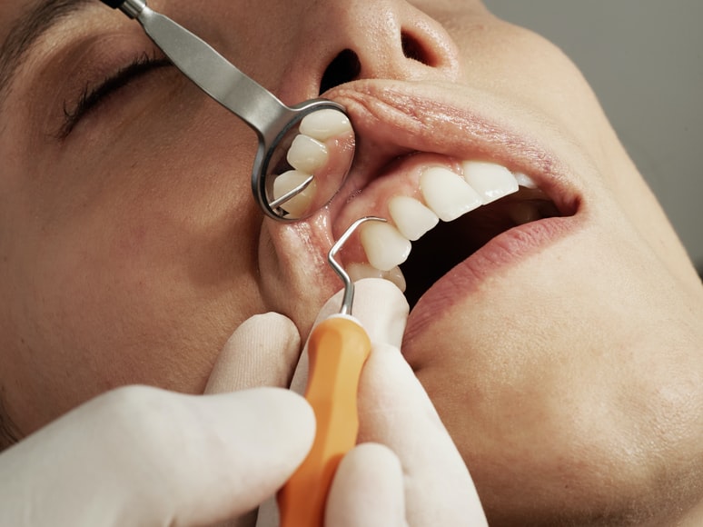 Image of a dentist performing mouth examination in dental practices for sale in Canada